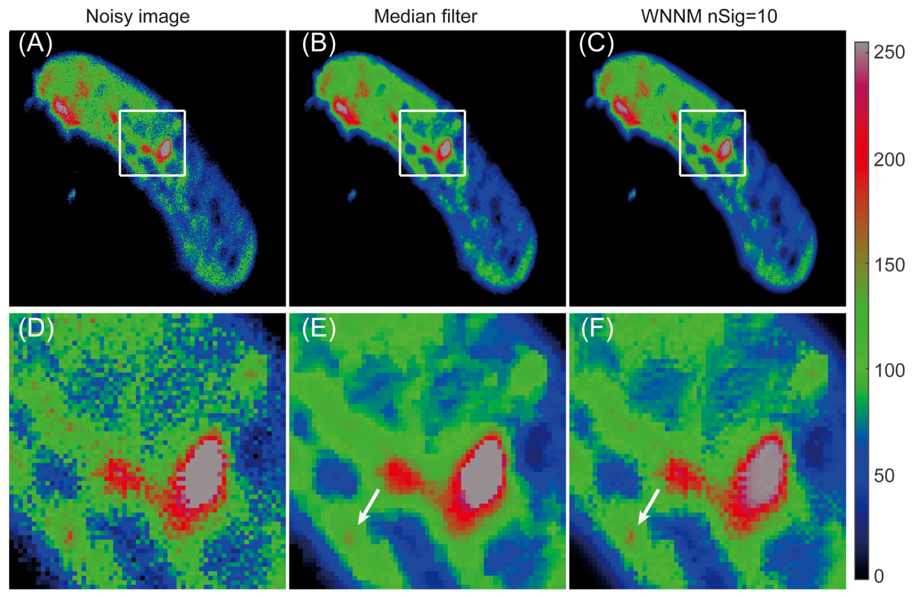 NanoSIMS image enhancement